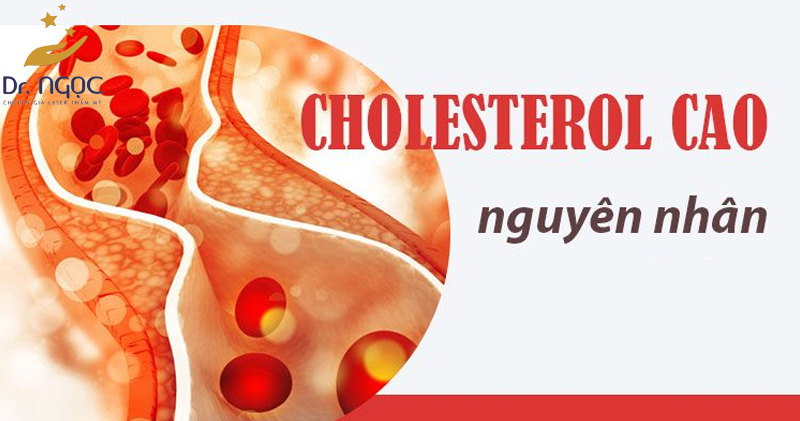 Nguyên nhân dẫn đến Cholesterol trong máu cao