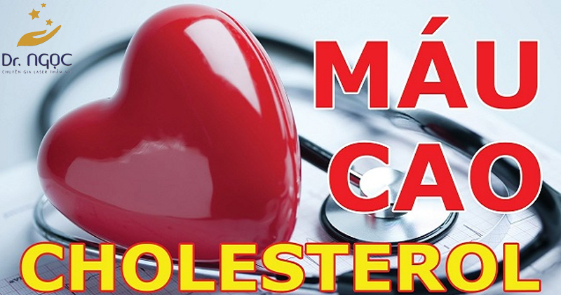Tìm hiểu về Cholesterol trong máu là gì?