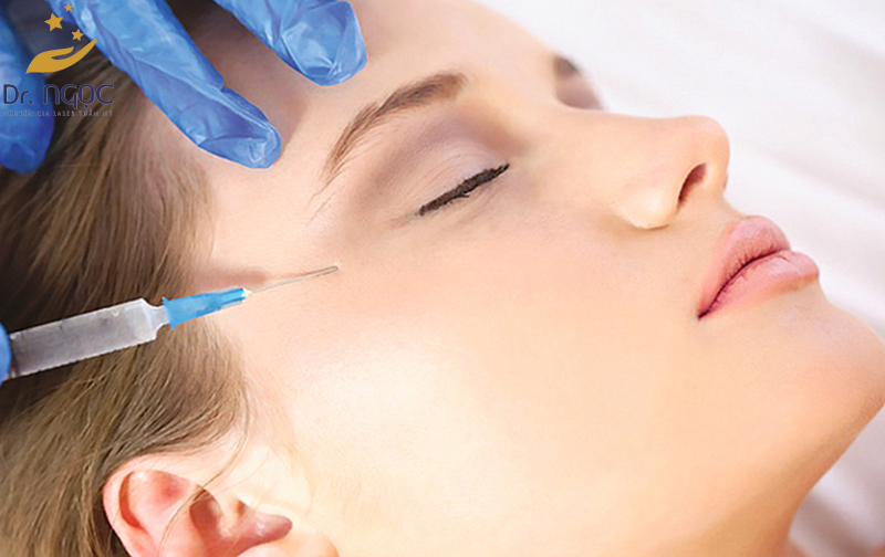 Phương pháp tiêm Botox mang lại hiệu quả cao trong điều trị nếp nhăn