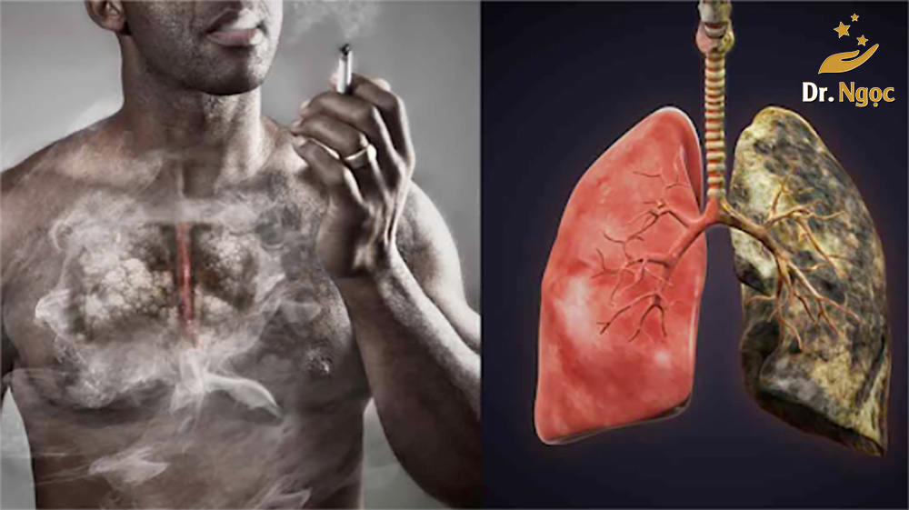 5 cách bỏ thuốc lá dễ dàng sau khi áp dụng