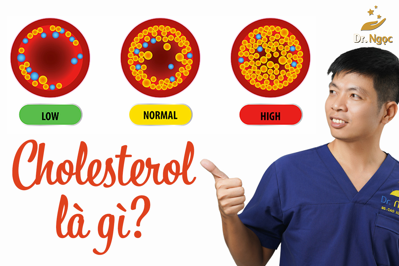 4 điều tổng quan về cholesterol là gì