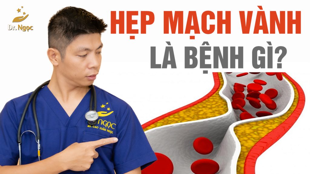 bệnh hẹp mạch vàng dr ngọc