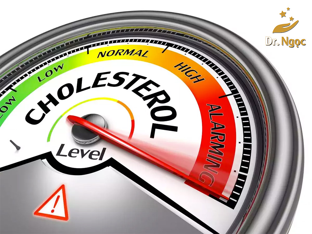 4 điều tổng quan về cholesterol là gì