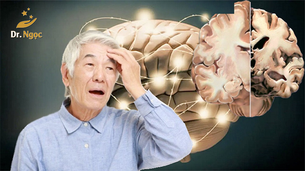 tác dụng của curcumin đối với bệnh alzheimer dr ngọc