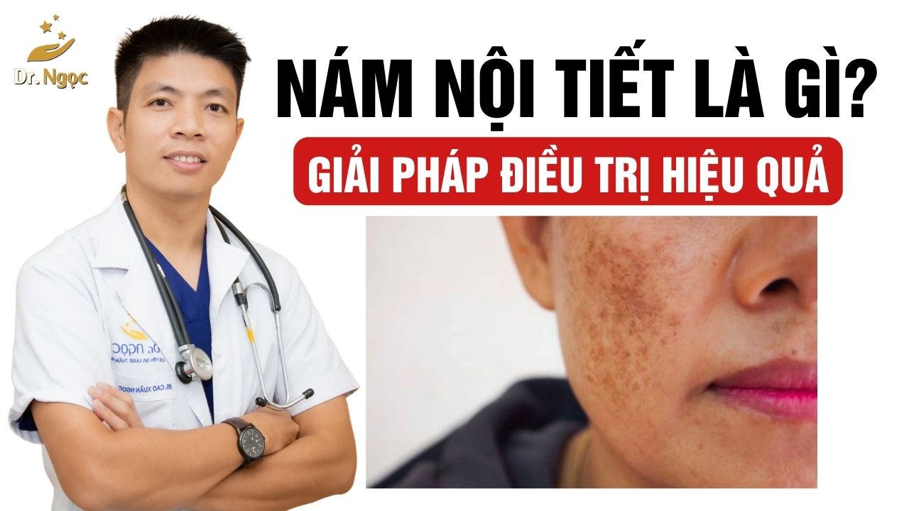 7. Lợi Ích Của Việc Điều Trị và Phòng Ngừa Nám Nội Tiết