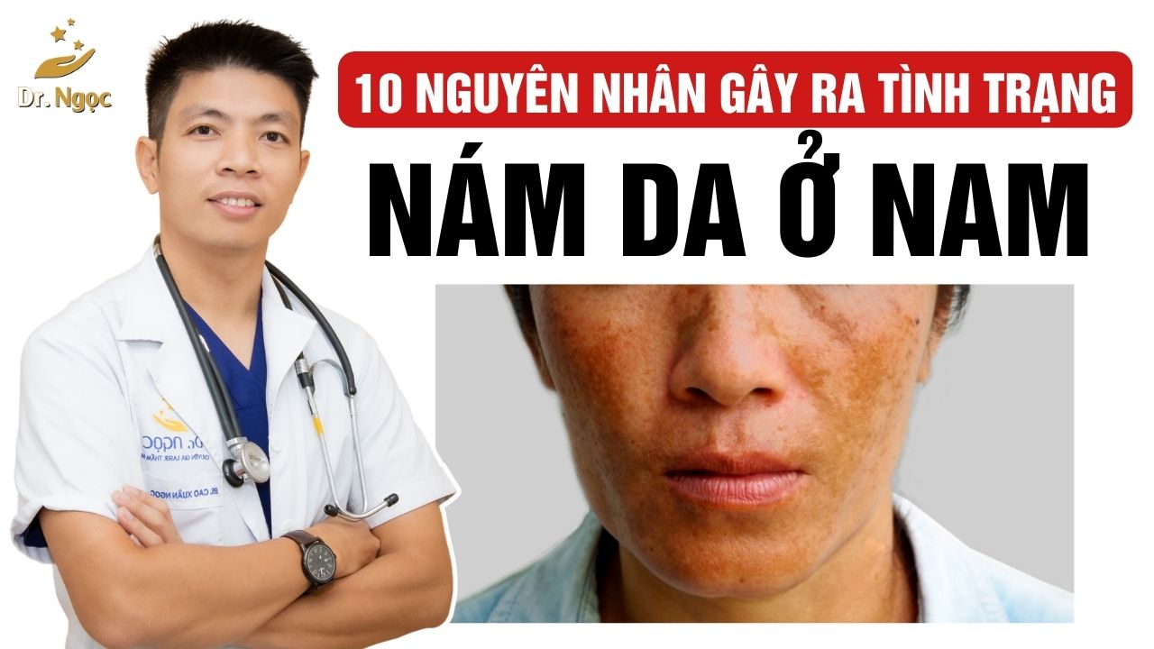 10 nguyên nhân gây nám da ở nam giới Dr Ngọc