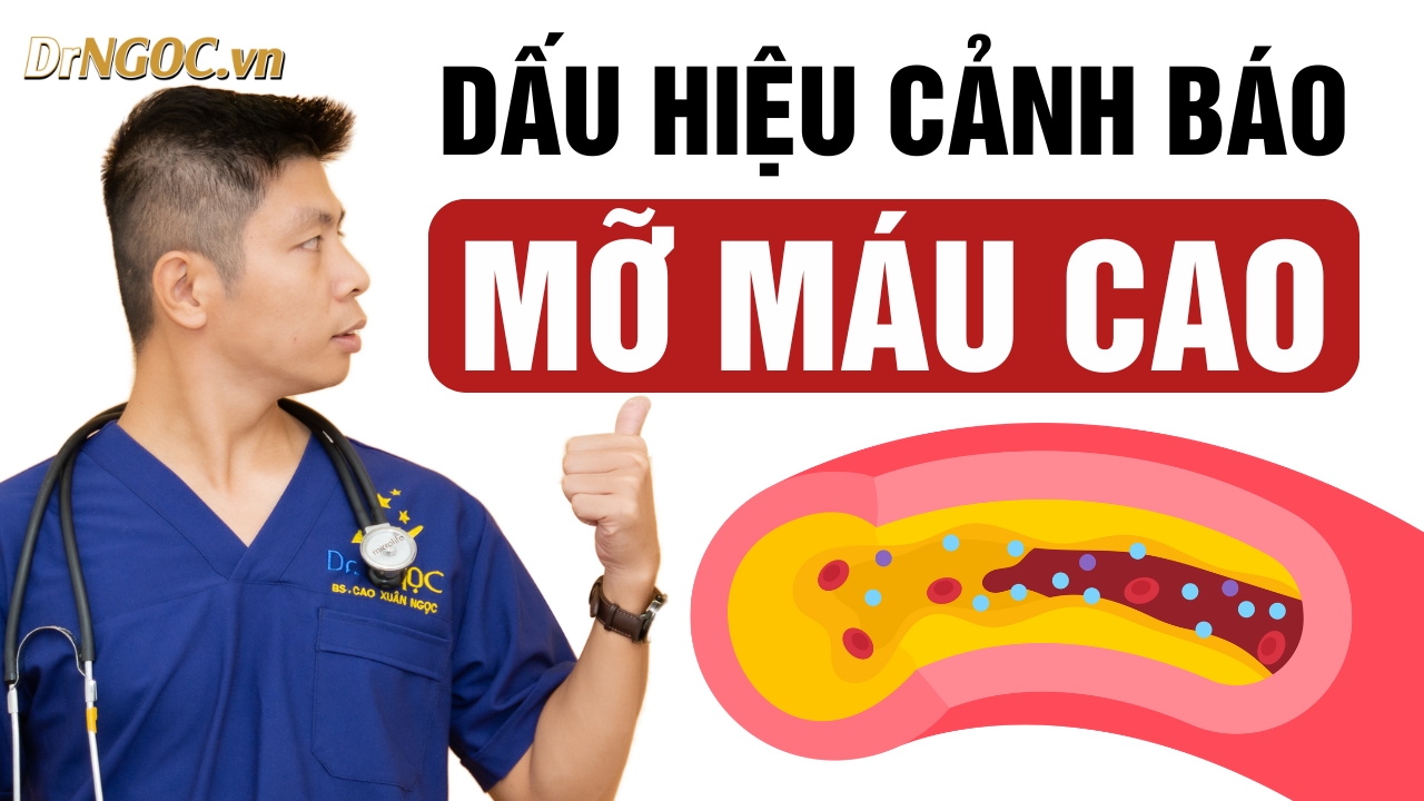 Dấu hiệu mỡ máu cao