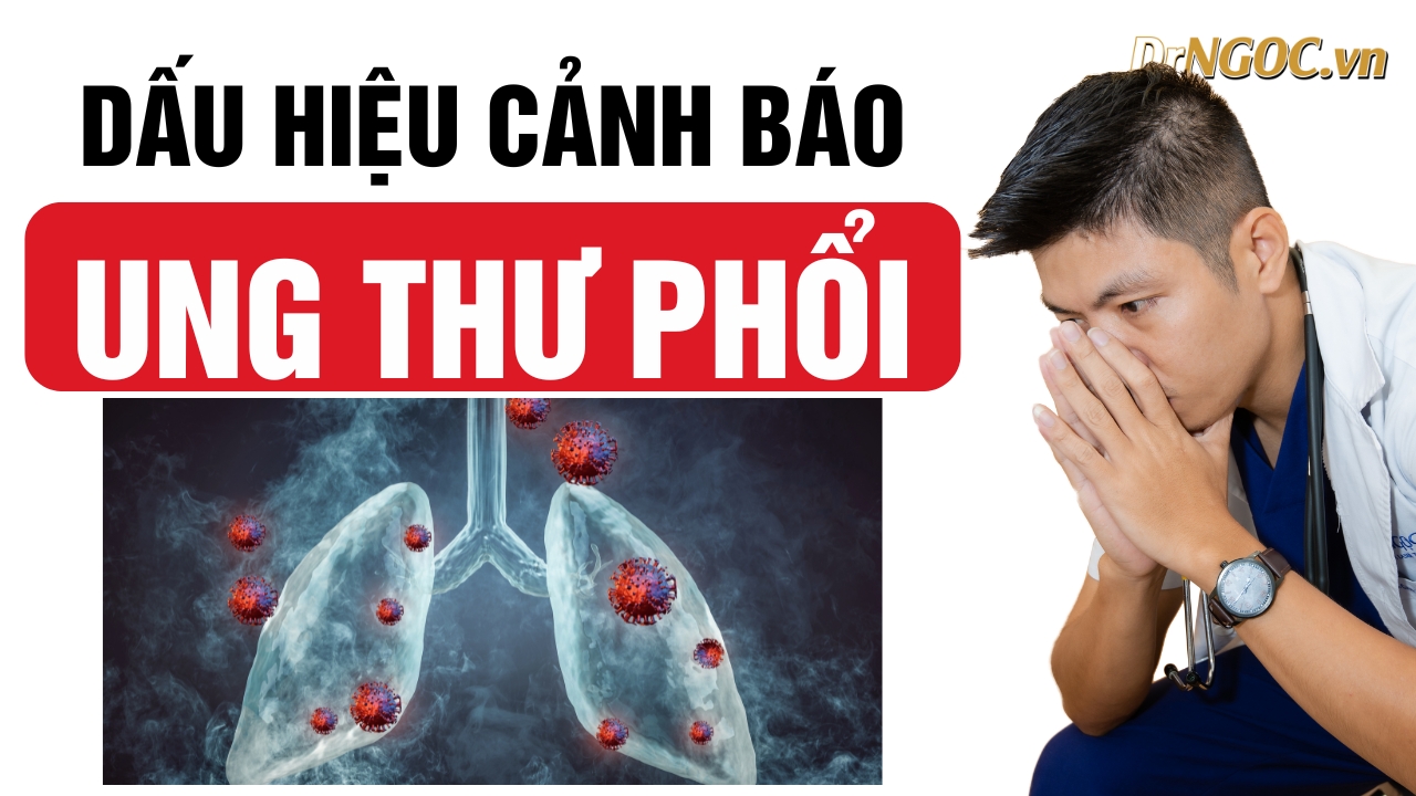 Dấu hiệu ung thư phổi