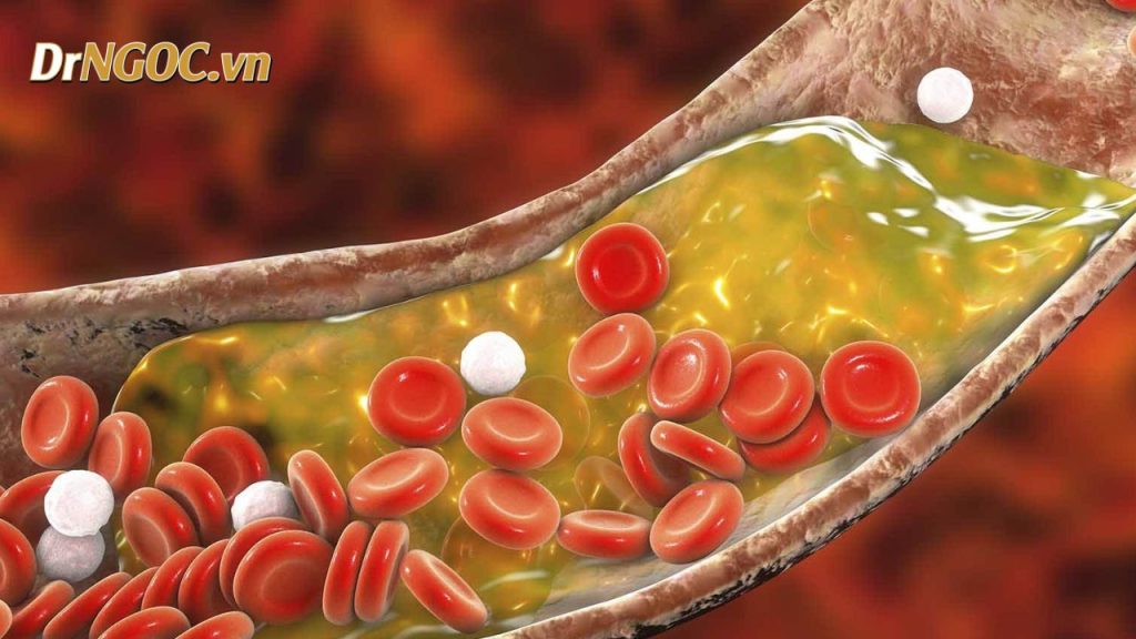 Giới thiệu về Giảm Cholesterol Tự Nhiên