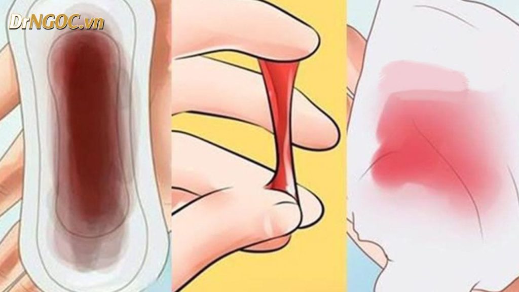 Dấu Hiệu Ung Thư Cổ Tử Cung