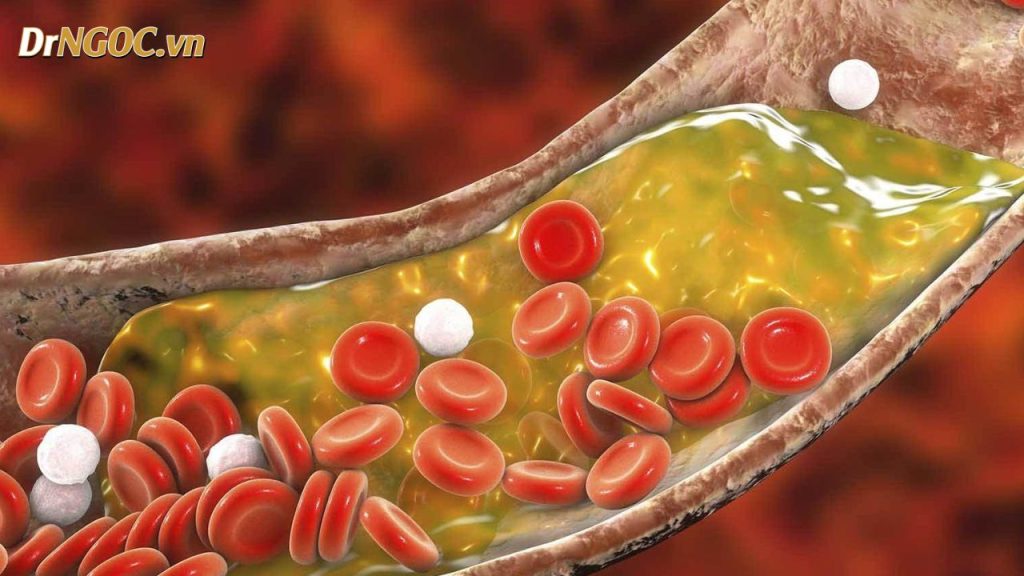 Huyết áp là gì và vì sao nó thay đổi? Dr Ngọc 